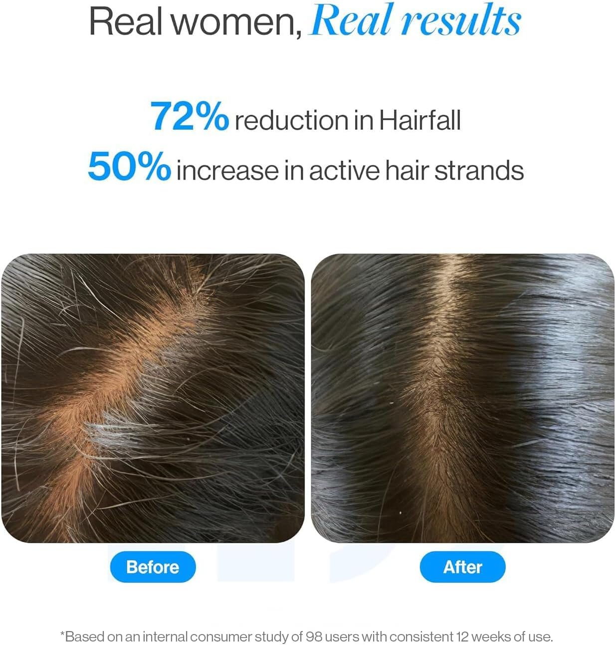 Roll-On Hair Growth Serum